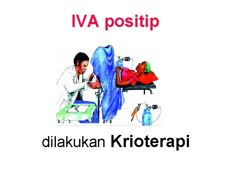 IVA positip dilakukan Krioterapi 