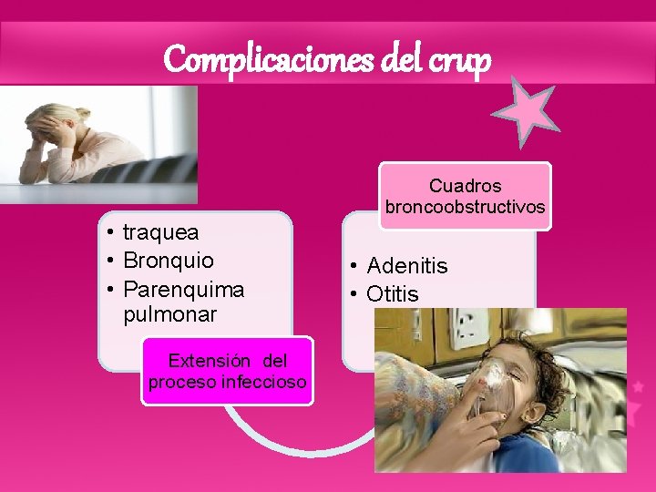 Complicaciones del crup Cuadros broncoobstructivos • traquea • Bronquio • Parenquima pulmonar Extensión del