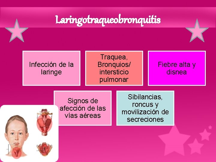 Laringotraqueobronquitis Infección de la laringe Traquea, Bronquios/ intersticio pulmonar Signos de afección de las