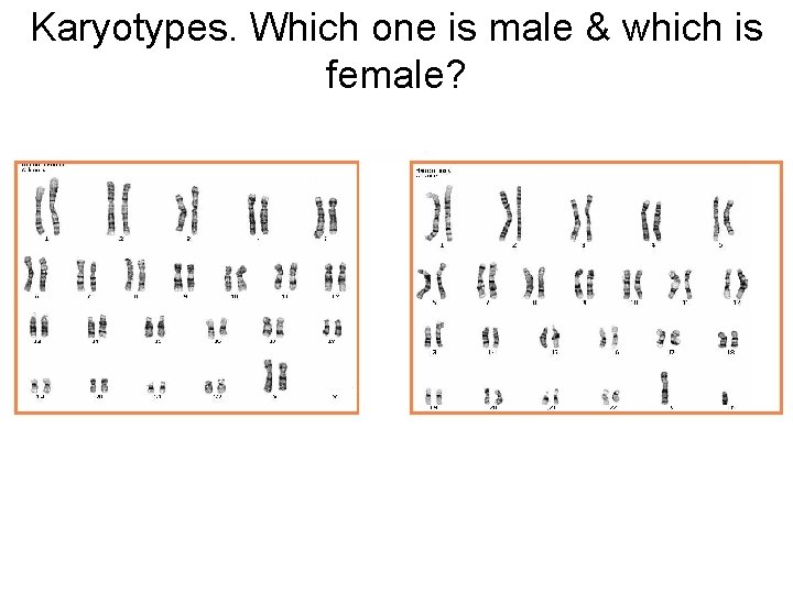 Karyotypes. Which one is male & which is female? Karyotypes. Which one is male & which is female?