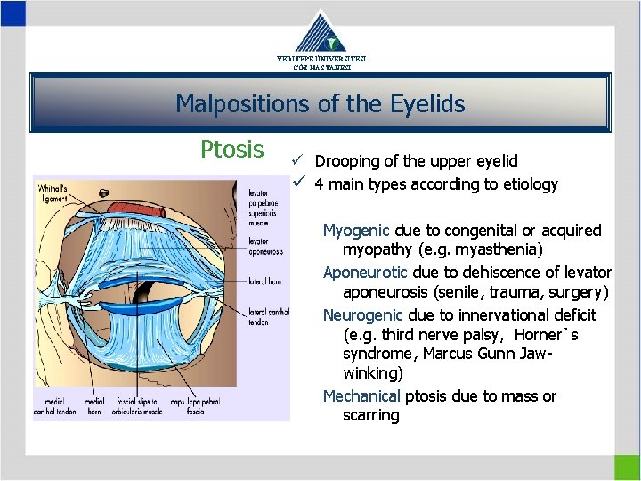 YEDİTEPE ÜNİVERSİTESİ GÖZ HASTANESİ Malpositions of the Eyelids Ptosis ü Drooping of the upper