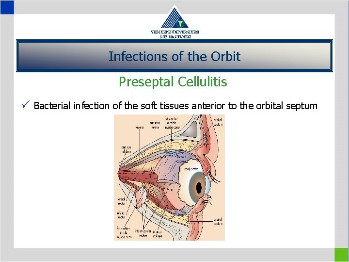 YEDİTEPE ÜNİVERSİTESİ GÖZ HASTANESİ Infections of the Orbit Preseptal Cellulitis ü Bacterial infection of