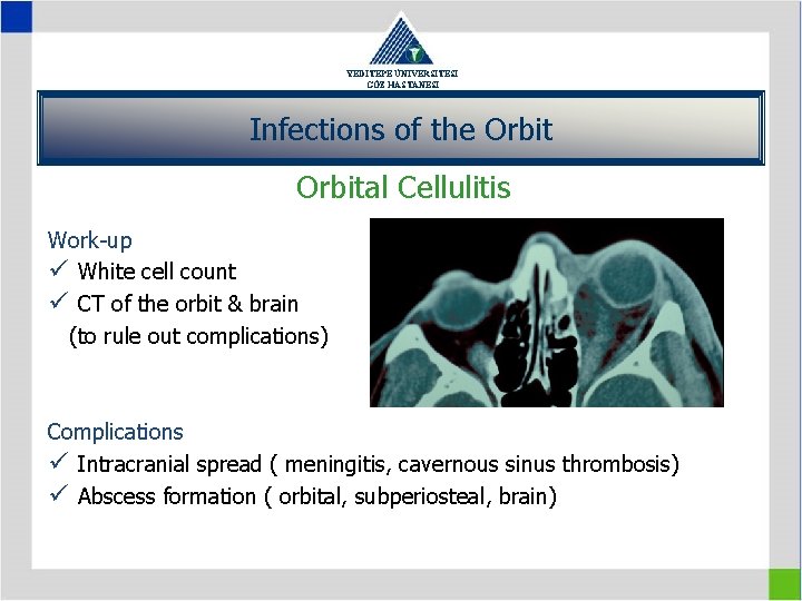 YEDİTEPE ÜNİVERSİTESİ GÖZ HASTANESİ Infections of the Orbital Cellulitis Work-up ü White cell count