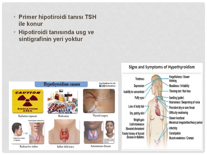  • Primer hipotiroidi tanısı TSH ile konur • Hipotiroidi tanısında usg ve sintigrafinin