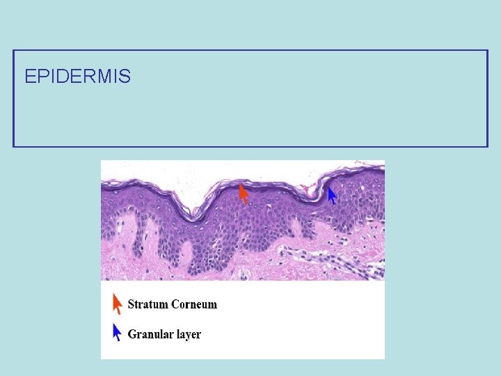 EPIDERMIS 