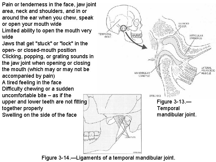 Pain or tenderness in the face, jaw joint area, neck and shoulders, and in Pain or tenderness in the face, jaw joint area, neck and shoulders, and in
