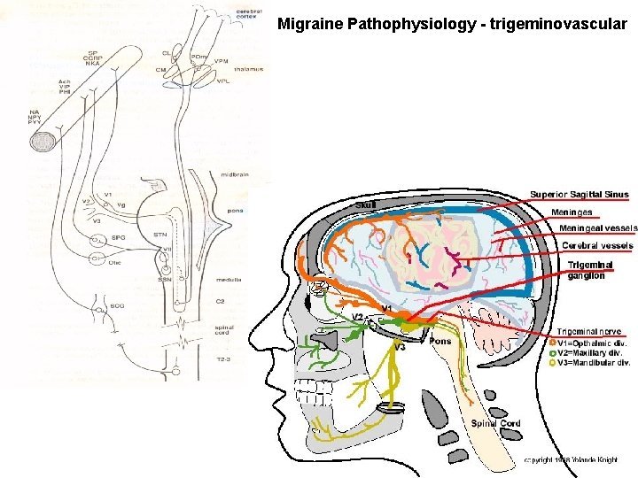 Migraine Pathophysiology - trigeminovascular Migraine Pathophysiology - trigeminovascular