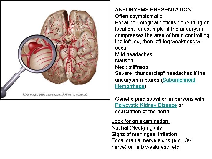 ANEURYSMS PRESENTATION Often asymptomatic Focal neurological deficits depending on location; for example, if the ANEURYSMS PRESENTATION Often asymptomatic Focal neurological deficits depending on location; for example, if the