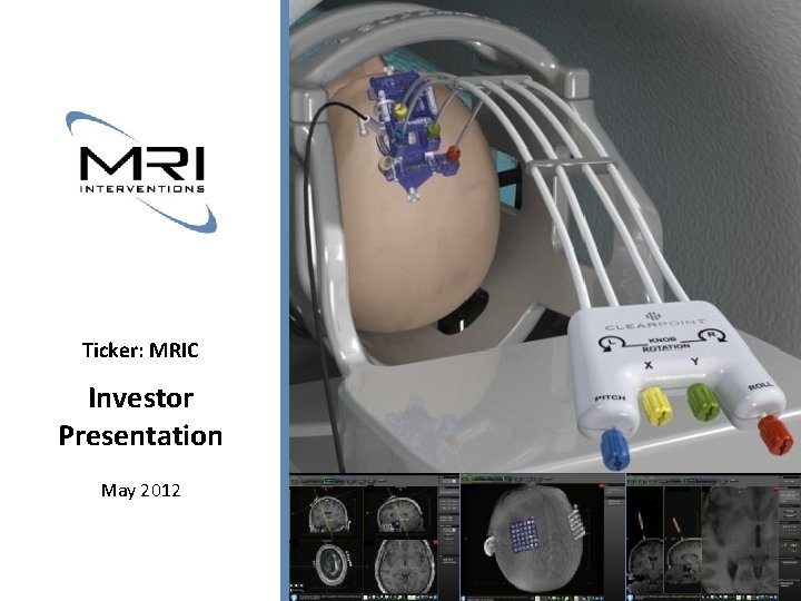 Ticker: MRIC Investor Presentation May 2012 MRI Interventions Investor Presentation 