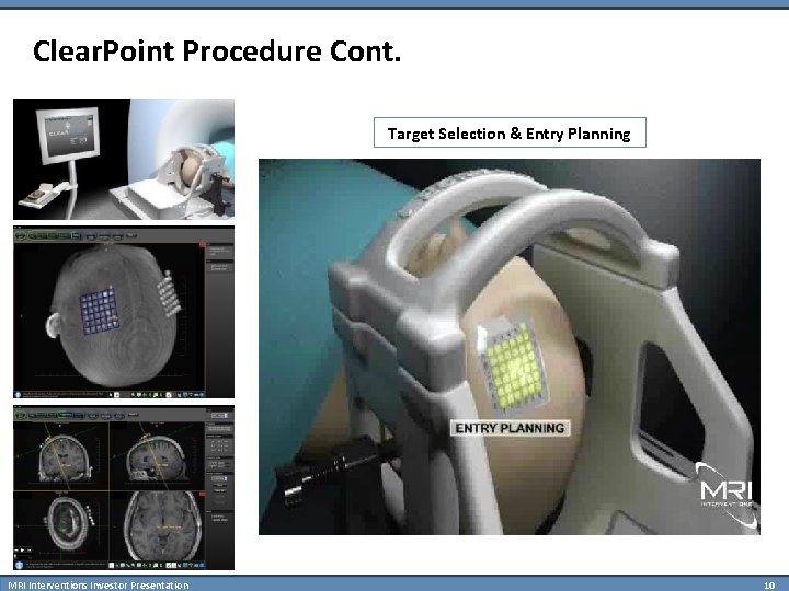 Clear. Point Procedure Cont. Target Selection & Entry Planning MRI Interventions Investor Presentation 10