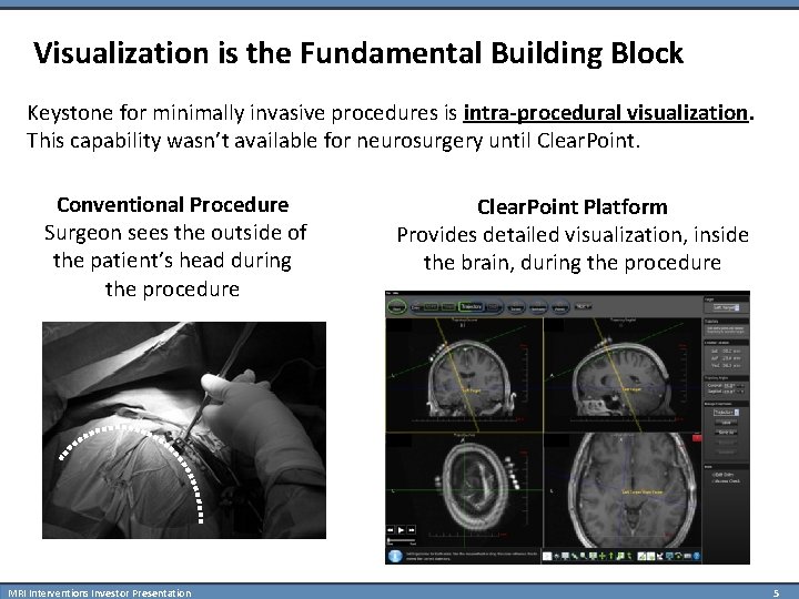 Visualization is the Fundamental Building Block Keystone for minimally invasive procedures is intra-procedural visualization.