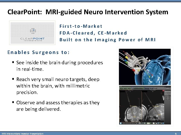 Clear. Point: MRI-guided Neuro Intervention System First-to-Market FDA-Cleared, CE-Marked Built on the Imaging Power