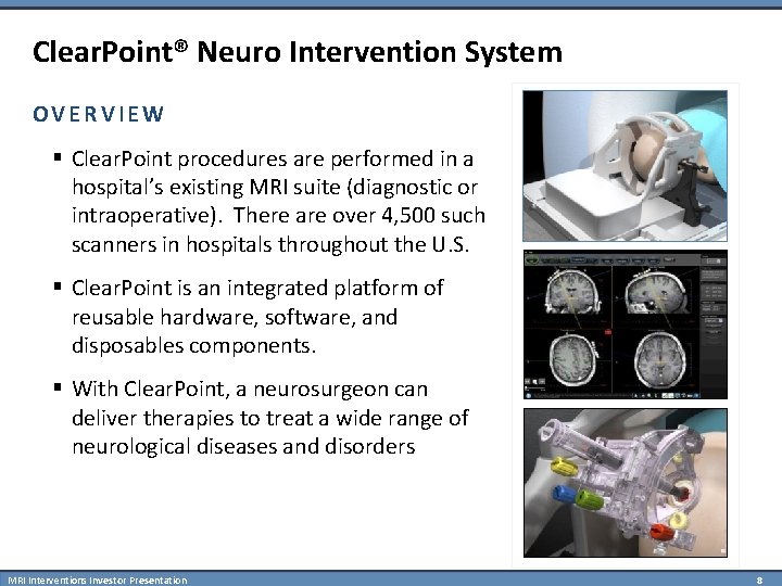 Clear. Point® Neuro Intervention System OVERVIEW § Clear. Point procedures are performed in a
