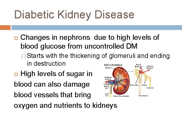 Diabetic Kidney Disease Changes in nephrons due to high levels of blood glucose from