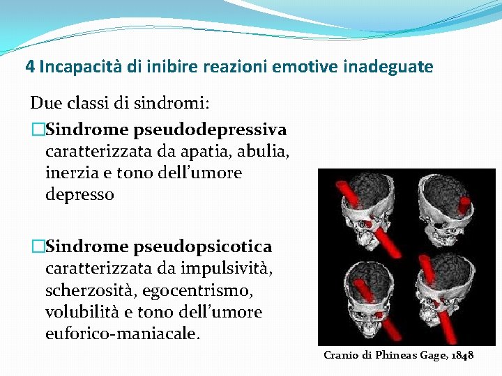 4 Incapacità di inibire reazioni emotive inadeguate Due classi di sindromi: �Sindrome pseudodepressiva caratterizzata