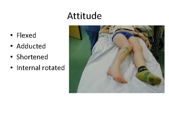 Attitude • • Flexed Adducted Shortened Internal rotated 