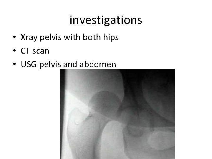 investigations • Xray pelvis with both hips • CT scan • USG pelvis and