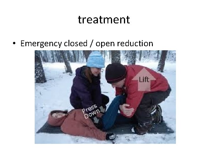 treatment • Emergency closed / open reduction 