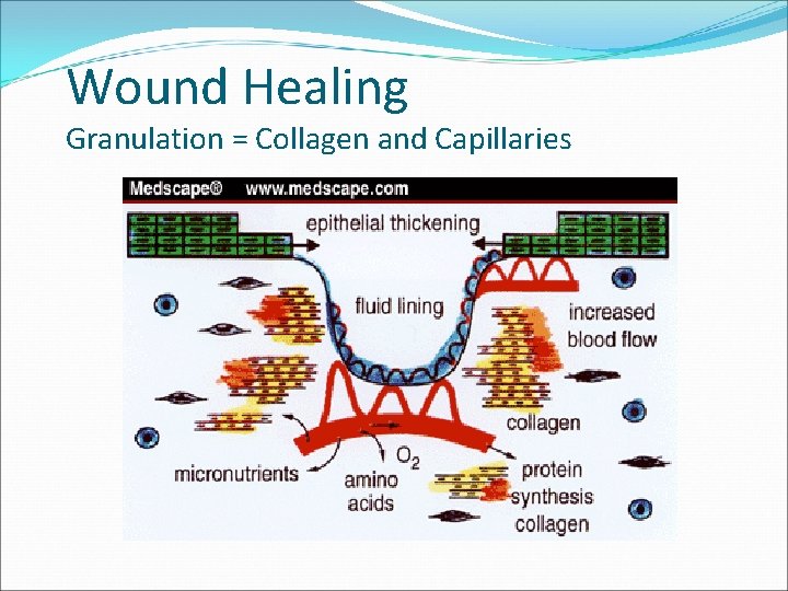 Wound Healing Granulation = Collagen and Capillaries 