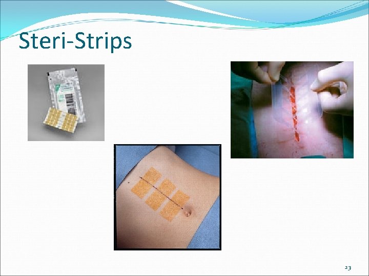 Steri-Strips 23 