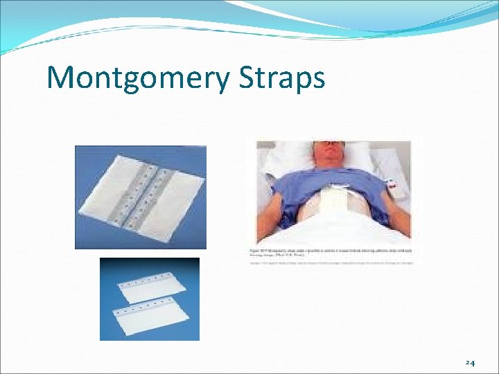 Montgomery Straps 24 