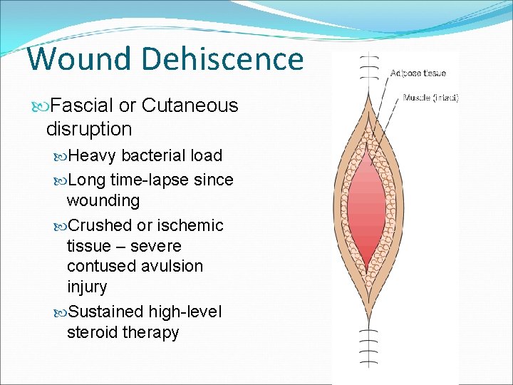 Wound Dehiscence Fascial or Cutaneous disruption Heavy bacterial load Long time-lapse since wounding Crushed