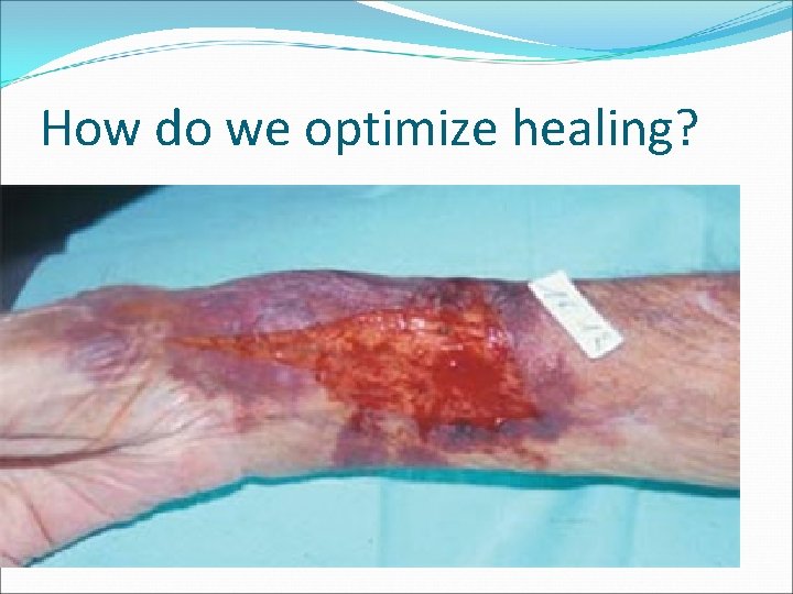 How do we optimize healing? 