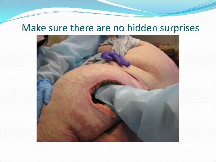 Make sure there are no hidden surprises 