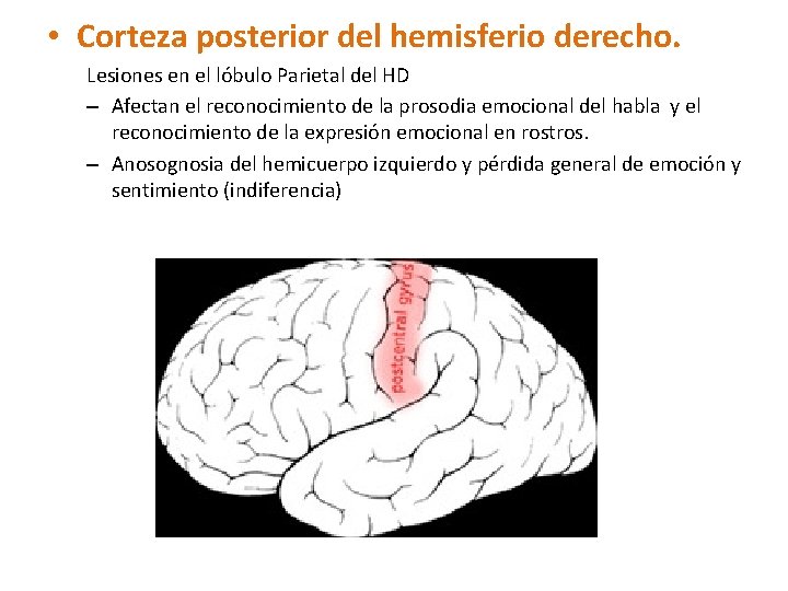  • Corteza posterior del hemisferio derecho. Lesiones en el lóbulo Parietal del HD
