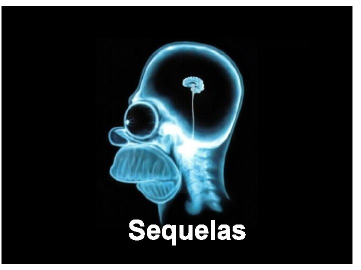 Sequelas 