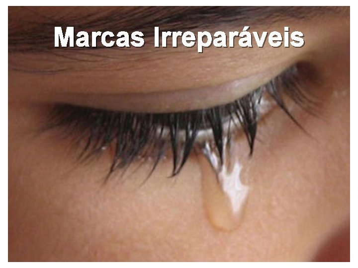 Marcas Irreparáveis 