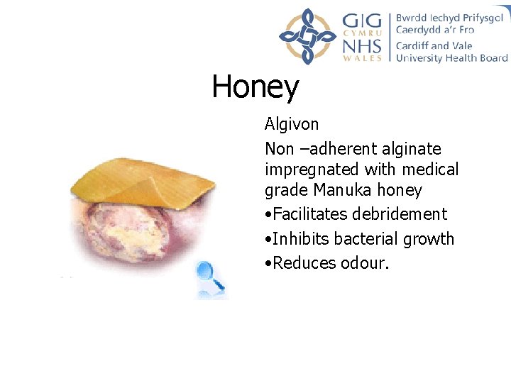 Honey Algivon Non –adherent alginate impregnated with medical grade Manuka honey • Facilitates debridement Honey Algivon Non –adherent alginate impregnated with medical grade Manuka honey • Facilitates debridement