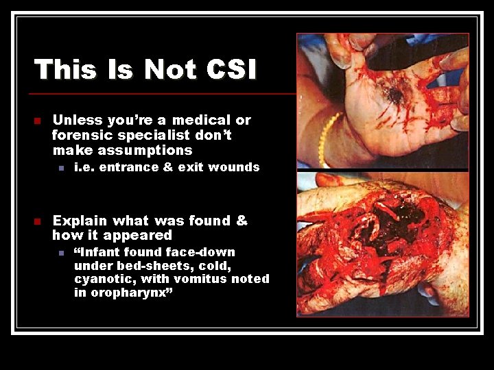 This Is Not CSI n Unless you’re a medical or forensic specialist don’t make