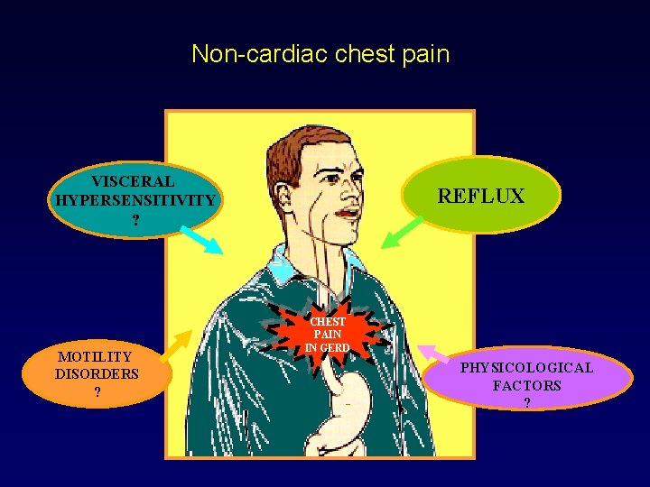 Non-cardiac chest pain VISCERAL HYPERSENSITIVITY ? MOTILITY DISORDERS ? REFLUX CHEST PAIN IN GERD