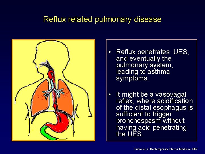 Reflux related pulmonary disease • Reflux penetrates UES, and eventually the pulmonary system, leading