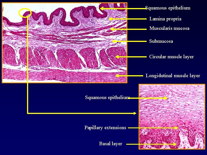 Squamous epithelium Lamina propria Muscularis mucosa Submucosa Circular muscle layer Longidutinal muscle layer Squamous