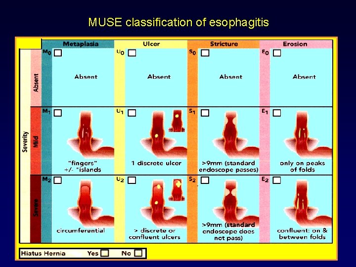 MUSE classification of esophagitis 