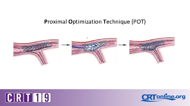 Proximal Optimization Technique (POT) Proximal Optimization Technique (POT)