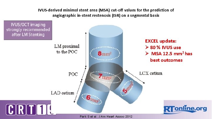 IVUS-derived minimal stent area (MSA) cut-off values for the prediction of angiographic in-stent restenosis IVUS-derived minimal stent area (MSA) cut-off values for the prediction of angiographic in-stent restenosis