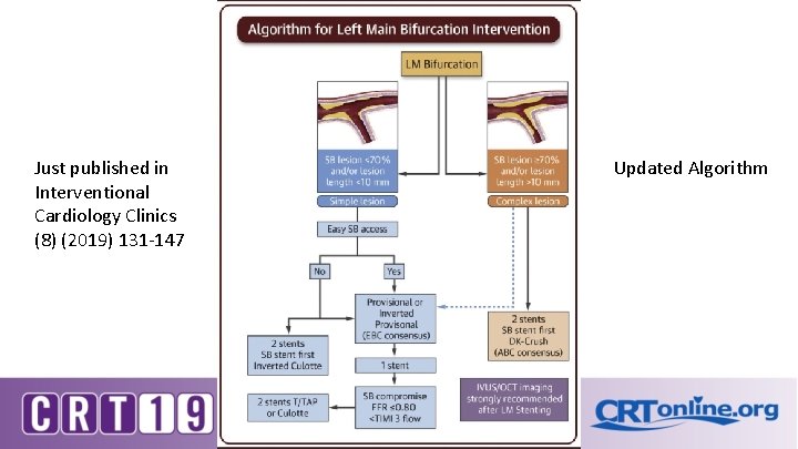 Just published in Interventional Cardiology Clinics (8) (2019) 131 -147 Updated Algorithm Just published in Interventional Cardiology Clinics (8) (2019) 131 -147 Updated Algorithm