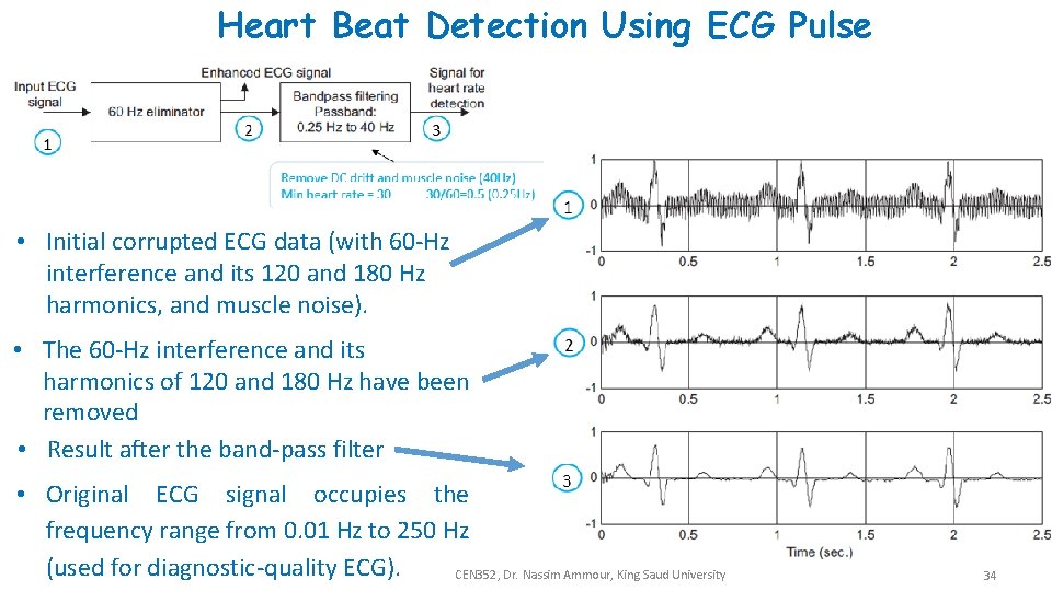 Heart Beat Detection Using ECG Pulse • Initial corrupted ECG data (with 60 -Hz