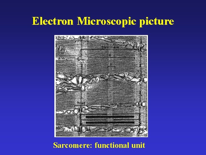 Electron Microscopic picture Sarcomere: functional unit 