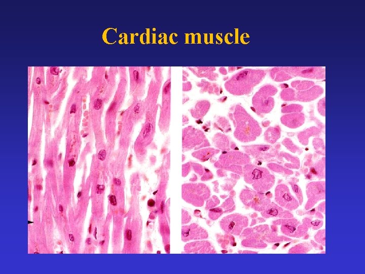 Cardiac muscle 