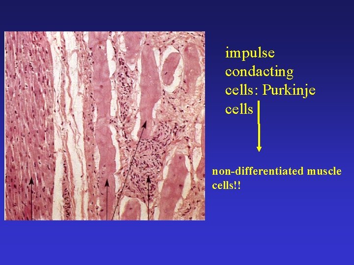 impulse condacting cells: Purkinje cells non-differentiated muscle cells!! 