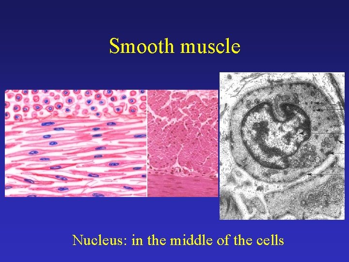 Smooth muscle Nucleus: in the middle of the cells 