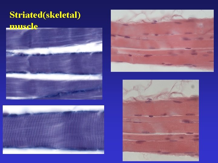 Striated(skeletal) muscle 