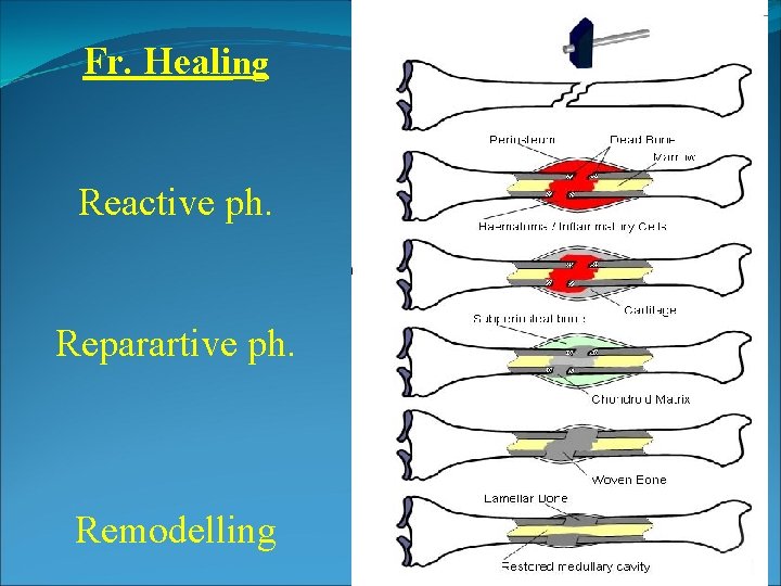 Fr. Healing Reactive ph. Reparartive ph. Remodelling Fr. Healing Reactive ph. Reparartive ph. Remodelling