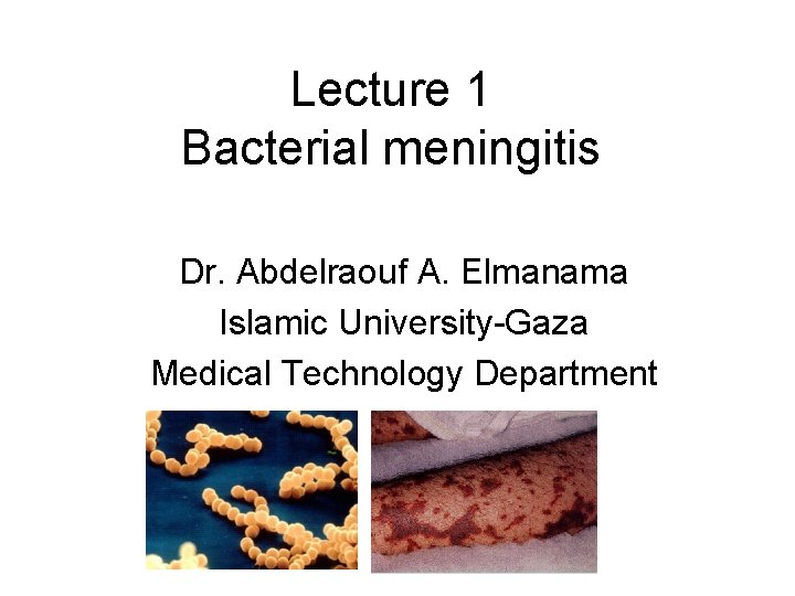 Lecture 1 Bacterial meningitis Dr. Abdelraouf A. Elmanama Islamic University-Gaza Medical Technology Department 