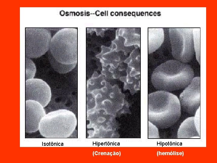 Isotônica Hipertônica Hipotônica (Crenação) (hemólise) 