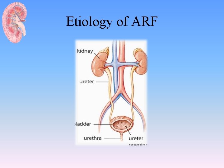 Etiology of ARF 